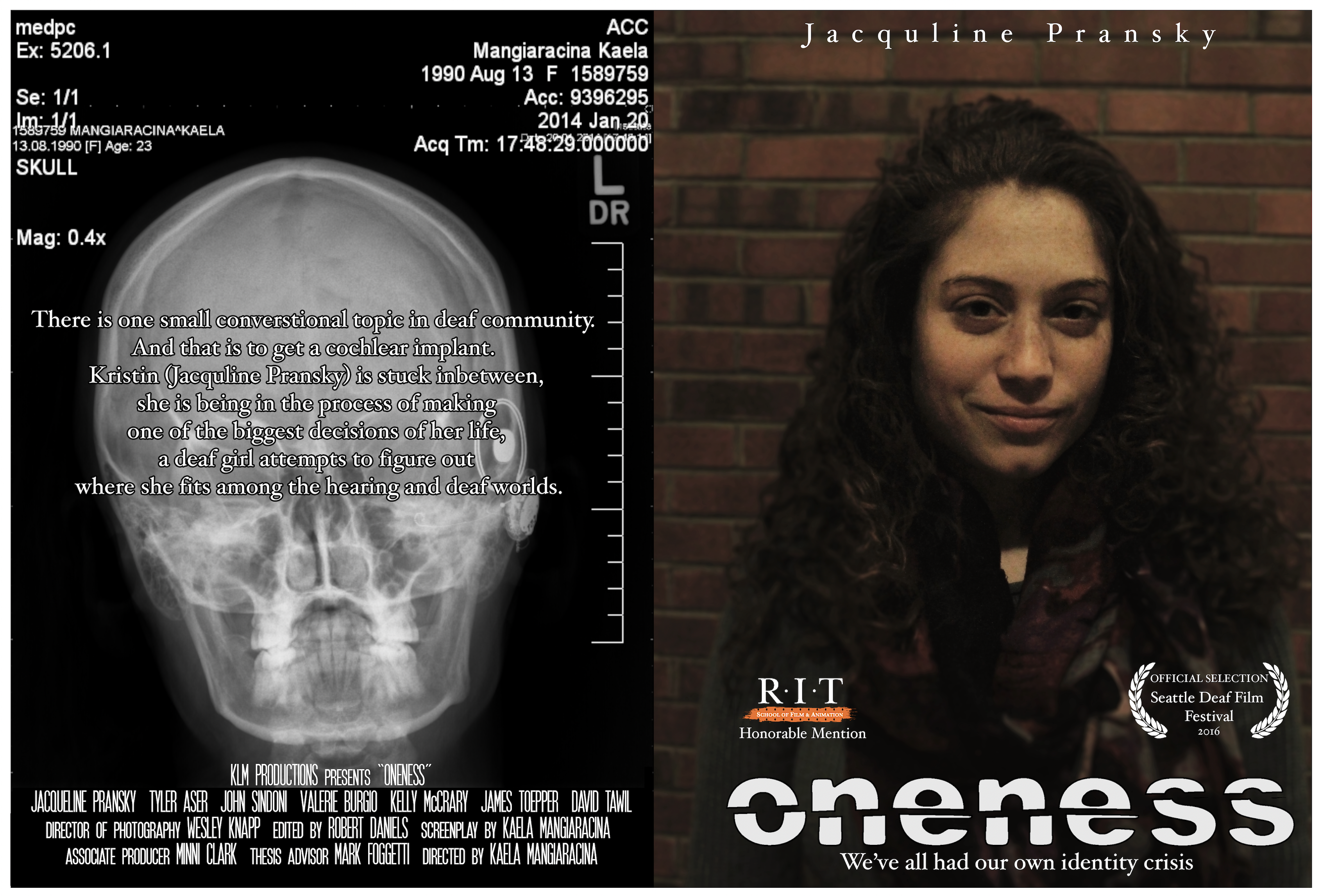 An xray of a skull and beside it a white woman with long black hair standing in front of a brick wall.